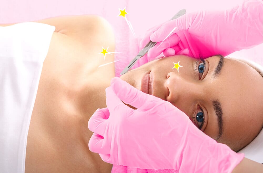 Dermaplaning: Messer statt Peeling?